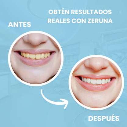 Mejor Higiene en 7 días con nuestro CLEENTHEET